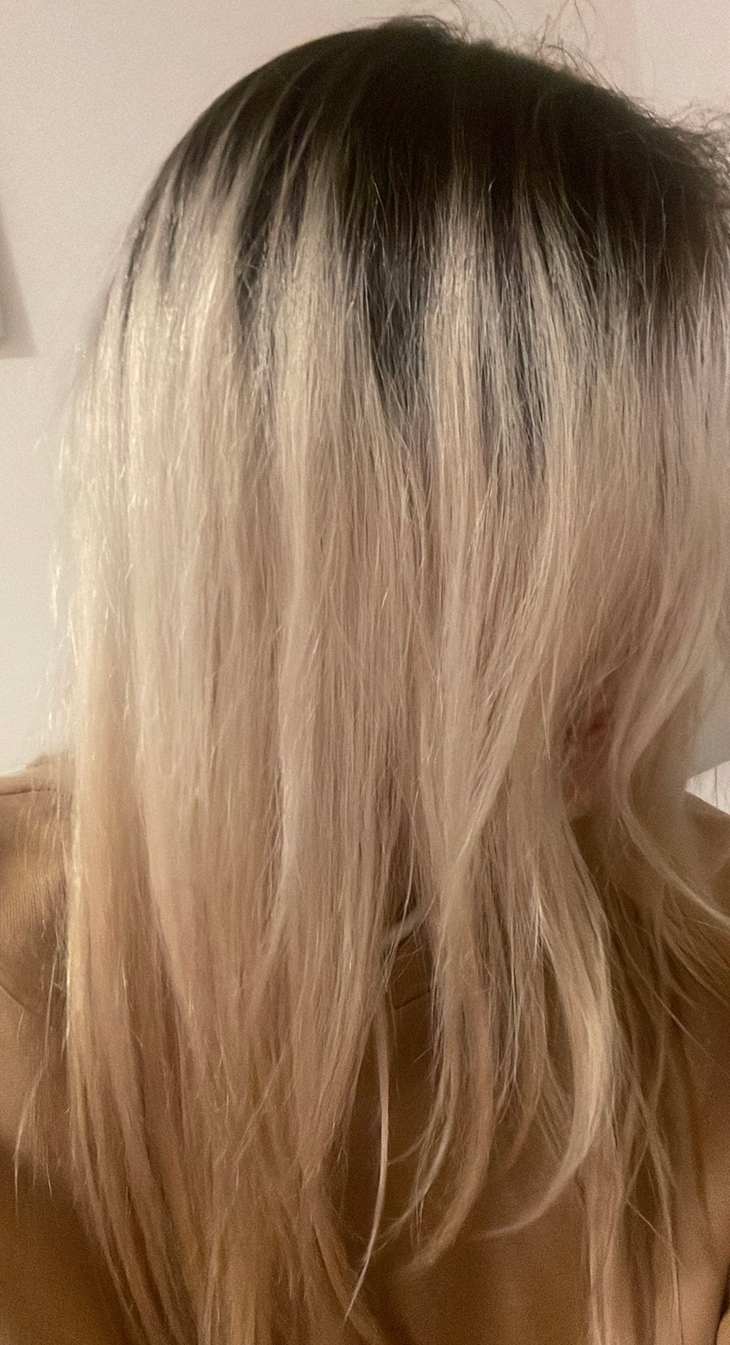 Stronger, Fuller Hair Starts at the Root 🌿
Reduce Hair Fall & Support New Growth Naturally