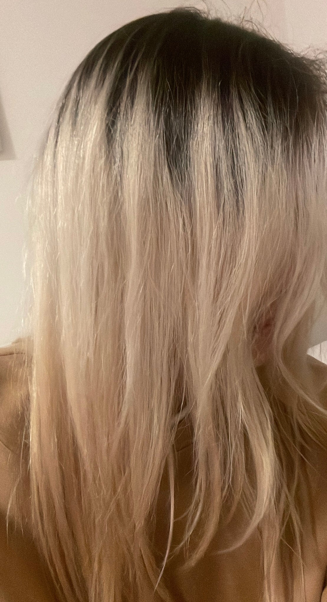 Stronger, Fuller Hair Starts at the Root 🌿
Reduce Hair Fall & Support New Growth Naturally