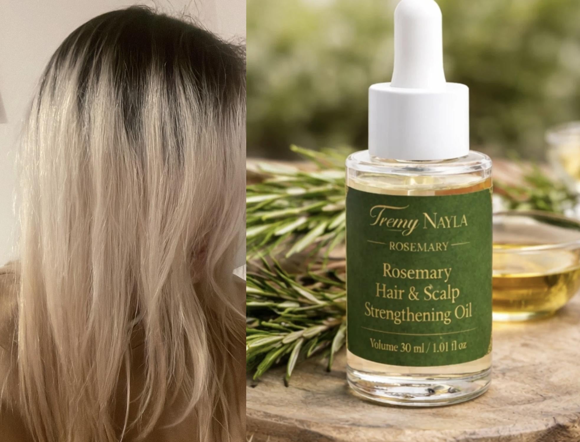 Stronger, Fuller Hair Starts at the Root 🌿
Reduce Hair Fall & Support New Growth Naturally