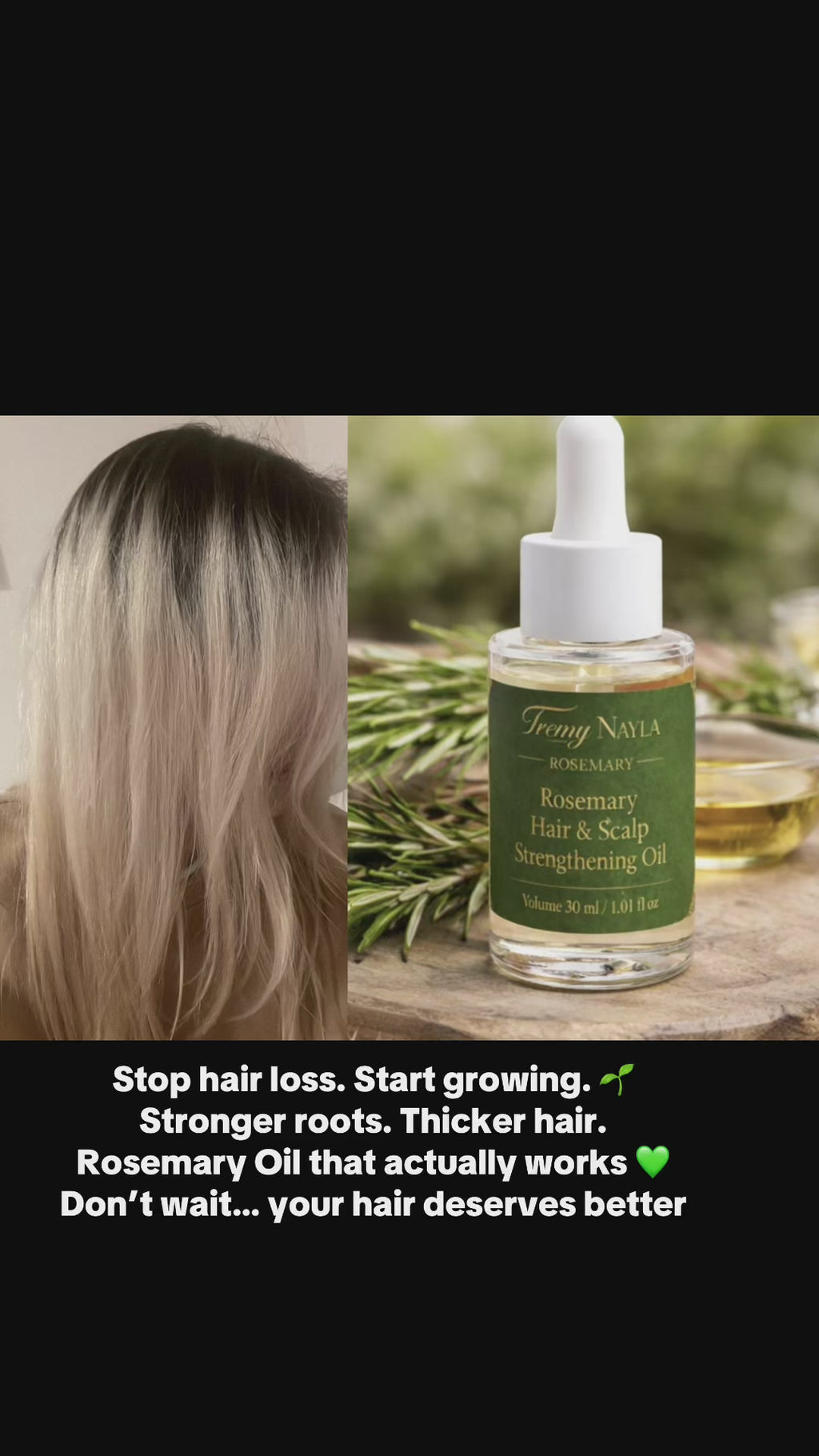 Stronger, Fuller Hair Starts at the Root 🌿
Reduce Hair Fall & Support New Growth Naturally