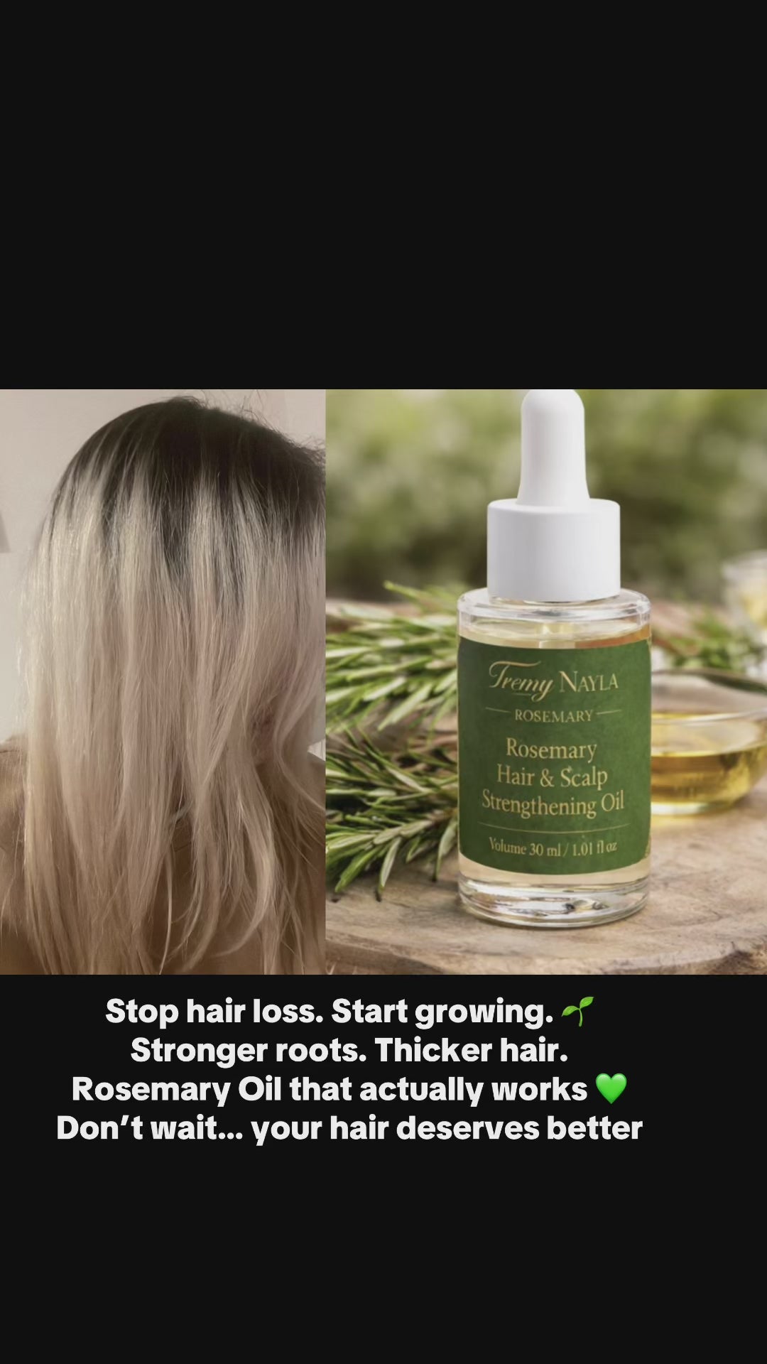 Stronger, Fuller Hair Starts at the Root 🌿
Reduce Hair Fall & Support New Growth Naturally